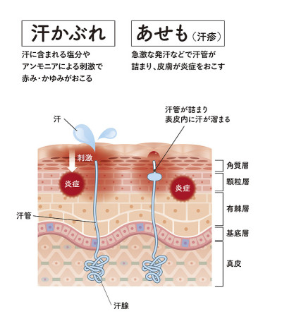 Cross section of the skin 31 front