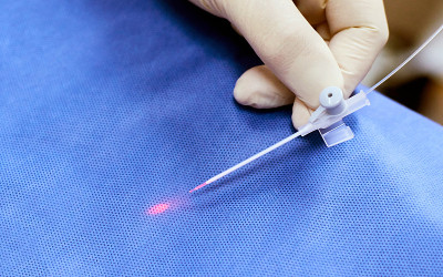 Laser removal veins. Treatment couperose device. V