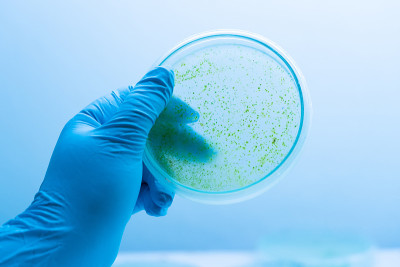 培养基板上蓝藻菌落，微生物学。