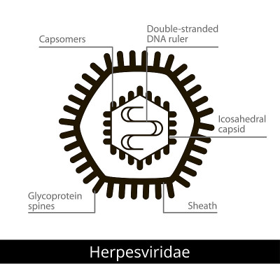 Herpesviridae。分类的病毒。