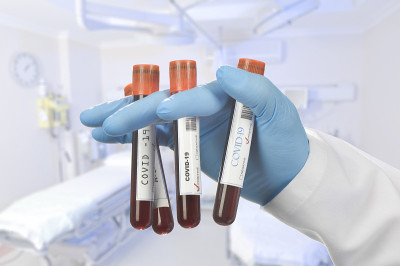 科学家拿着冠状病毒阳性试管。