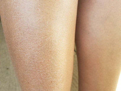 一个女人干瘪发痒的腿