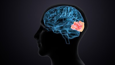 人脑交叉解剖学的三维渲染
