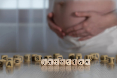 由木制字母组成的单词JAUNDICE。