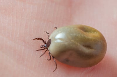人皮肤上长满血的蜱虫
