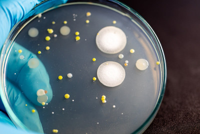 微生物实验室教育用土壤样品中细菌和霉菌在琼脂平板上生长的特点和不同形状菌落的背景。