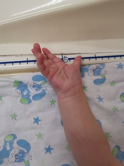 医疗反省的孩子