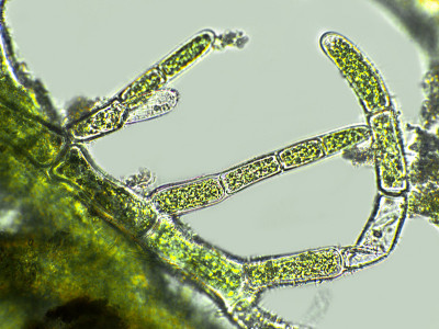 显微镜下的Cladophora sp. algae
