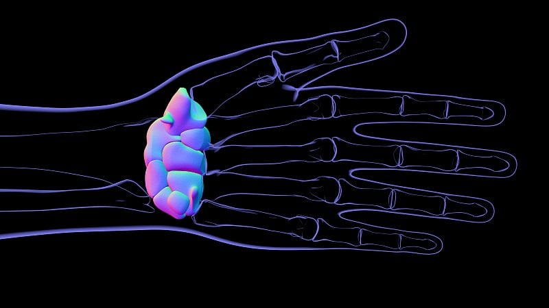 人体骨骼、手、腕关节骨解剖学的医学概念