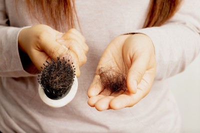 女性对洗发水过敏会导致脱发和头皮屑。