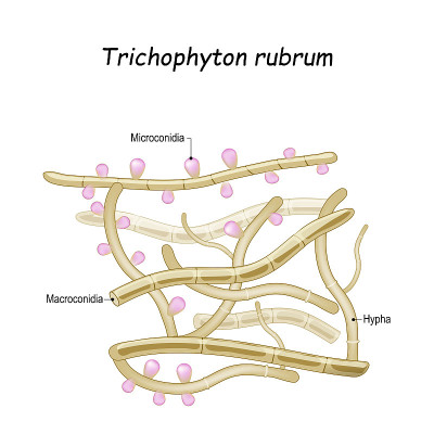 毛癣菌属石。真菌与可育菌丝，大分生孢子和微分生孢子的特写