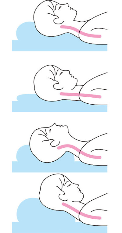 Pillow height and neck strain