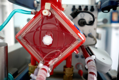医学。在重症监护室使用ecmo。特写镜头。