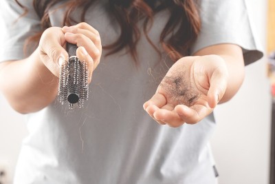 女性对洗发水过敏会导致脱发和头皮屑。