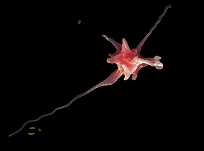 阿米巴(帕拉阿米巴perurans)， SEM