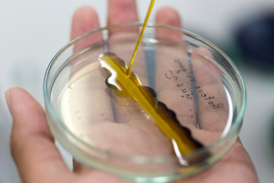 实验室用碘检测感染微生物。