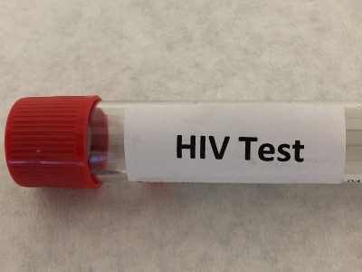 HIV实验室检测用试管