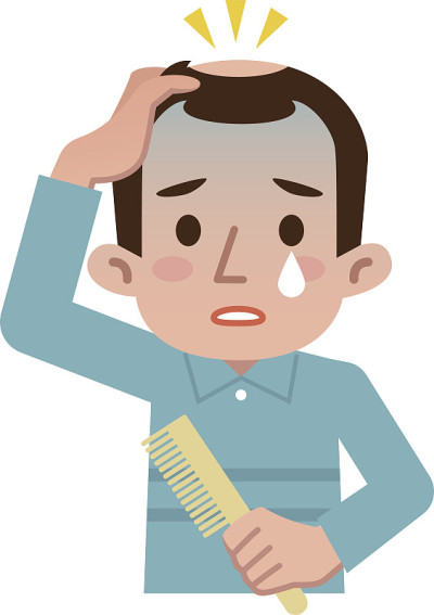男性脱发令人担忧