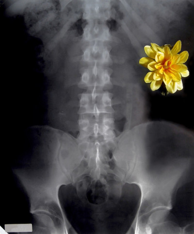 x射线的花