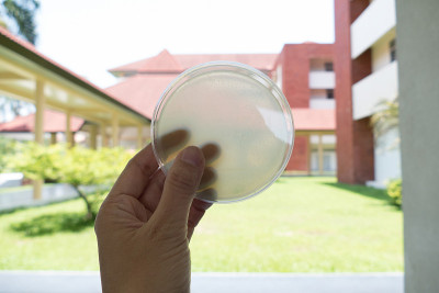 培养皿中琼脂培养基进行微生物板计数