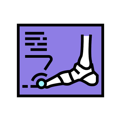 脚痛风疾病的x光片颜色图标矢量插图