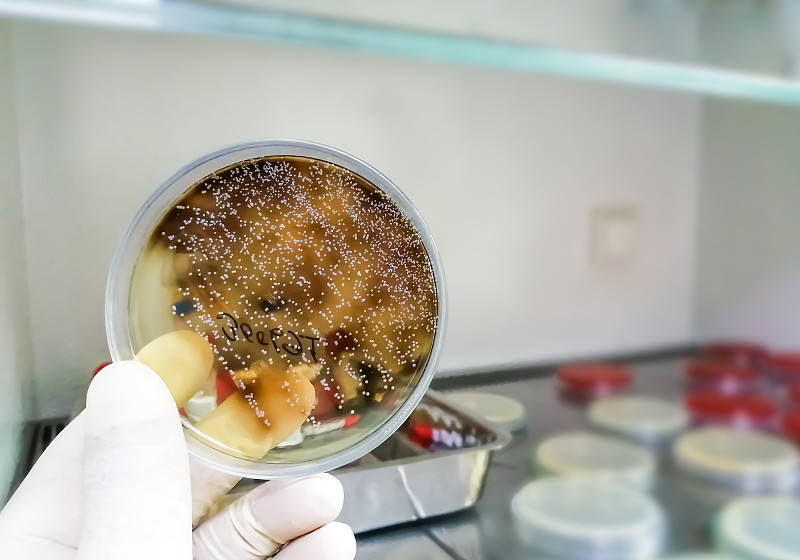 念珠菌属，微生物实验室背景。前视图。