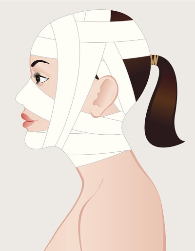 年轻女性整容手术后。