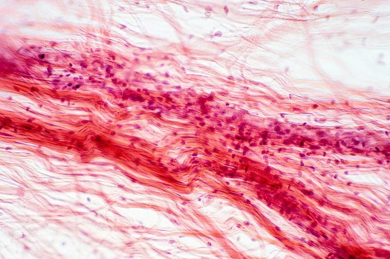 镜下为网状结缔组织。人类生理学的组织学。