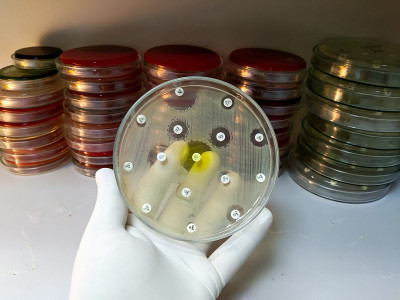 医学微生物实验室的药敏试验。抗菌药物对细菌的敏感性。
