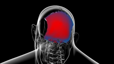 人类骨骼、头骨、枕骨解剖学的医学概念