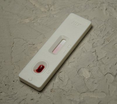 用一滴血进行HIV自检。艾滋病毒检测表达。