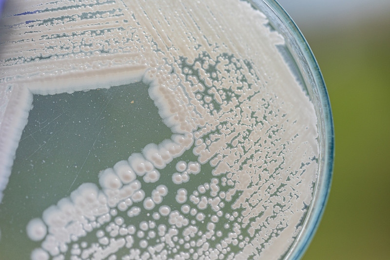 培养皿酵母菌，实验室微生物学教育。