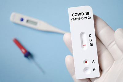 采用COVID-19快速检测、快速抗体护理点检测阳性结果。实验室进行抗体快速诊断测试，以检测COVI