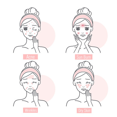 woman has facial skin problem