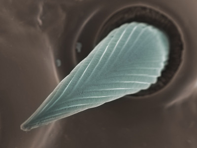 鹿关节脊柱， Sem