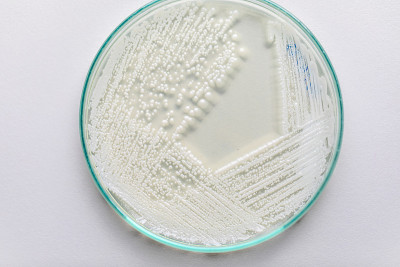 培养皿酵母菌，实验室微生物学教育。