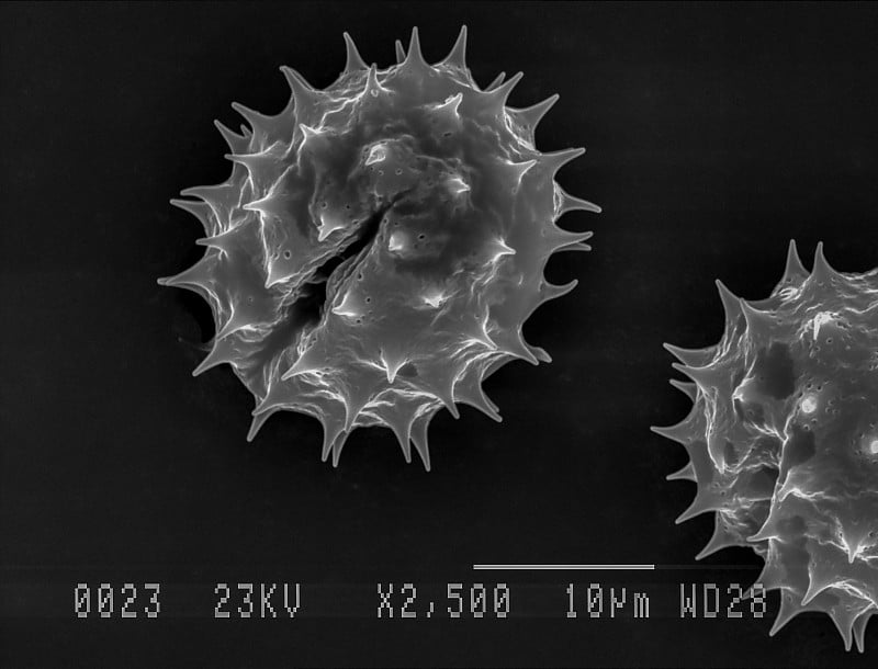 电子显微镜下观察雏菊花粉