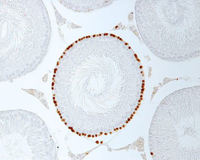 细精管。Spermatogonia