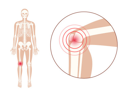 Pain in knee joint