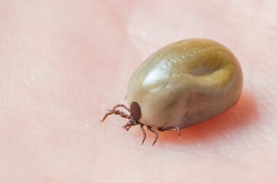人皮肤上长满血的蜱虫