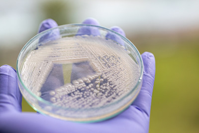 培养皿酵母菌，实验室微生物学教育。