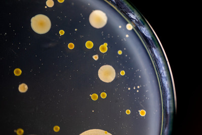 微生物实验室教育用土壤样品中细菌和霉菌在琼脂平板上生长的特点和不同形状菌落的背景。