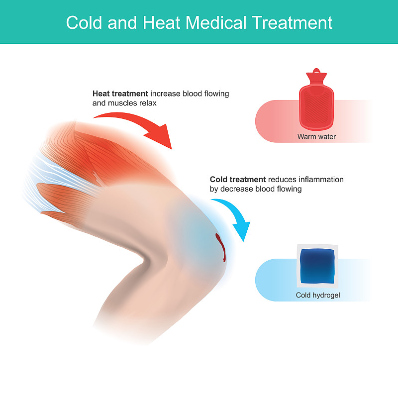 寒热医疗。这幅图解释了人类腿部不同的疼痛和损伤包括急救治疗。“n