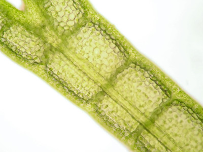 水生植物细胞的显微镜观察