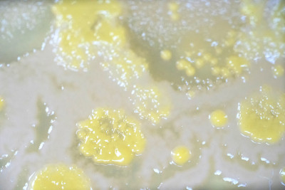培养基板细菌菌落，微生物学。