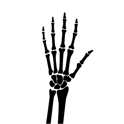 Arthrits