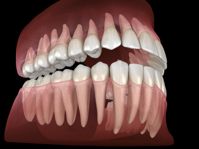 人类下颌和上颌牙龈和牙齿的形态。医学上准确的牙齿3D插图