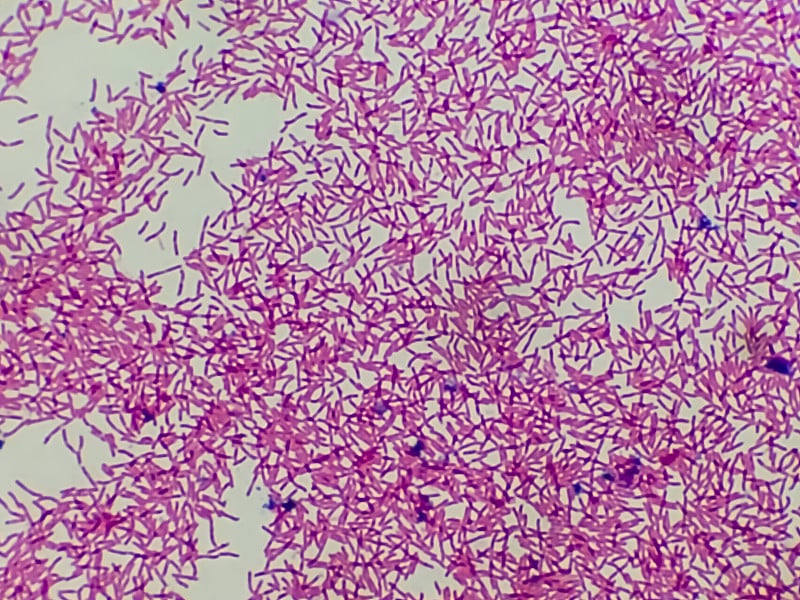 大肠杆菌(Escherichia coli)，又称大肠杆菌，是一种革兰氏阴性、兼性厌氧、杆状大肠菌。