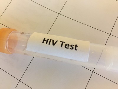 HIV实验室检测用试管