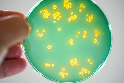 培养基板细菌菌落，微生物学。